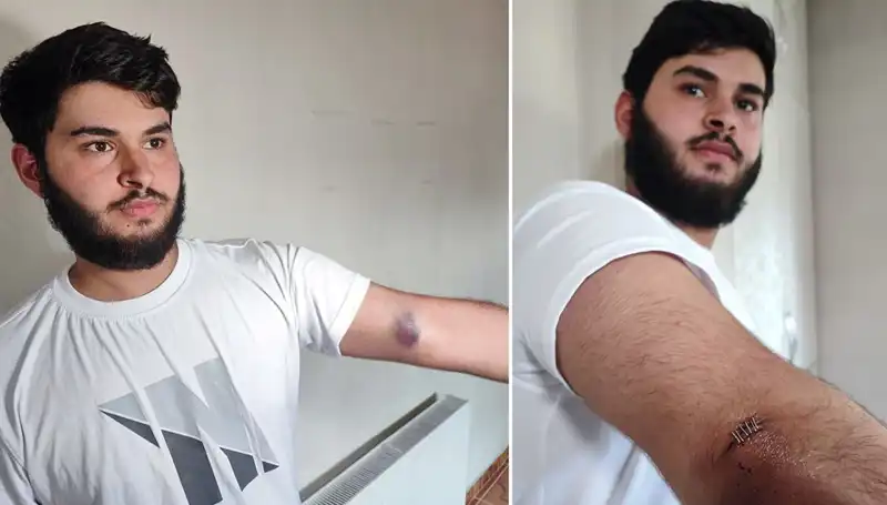 Bahçeye Kaçan Top, Mahallede Eğlenceli Kaosa Neden Oldu