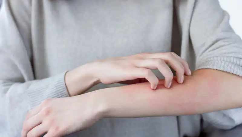 Cilt Kanseri Belirtilerini Tanıyın: Dermatologdan Önemli Uyarılar